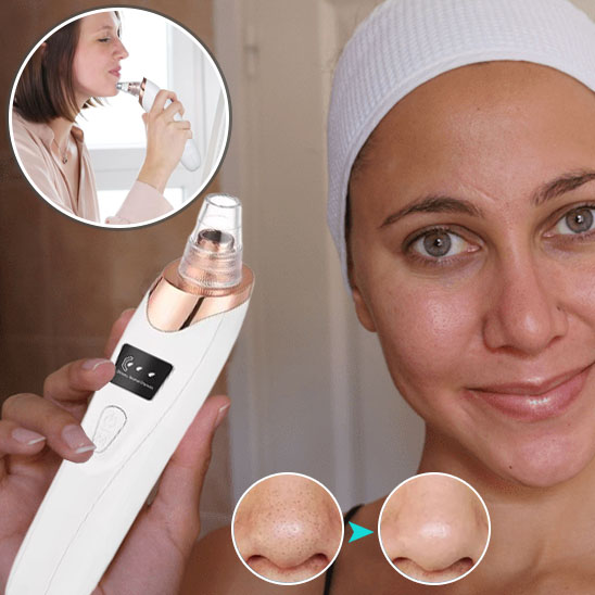 Découvrez l'aspirateur point noir qui élimine impuretés et stimule le collagène. Offrez-vous une peau nette et rajeunie en 5 minutes par semaine !